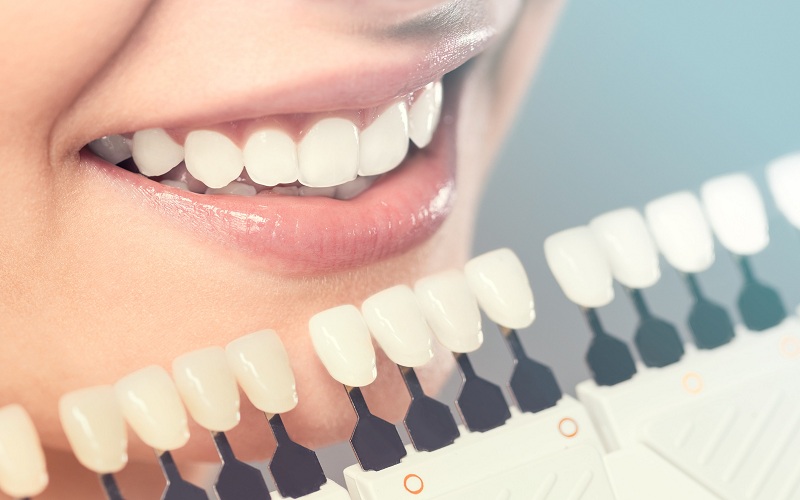 General Dentist’s Advice On Managing Tooth Discoloration