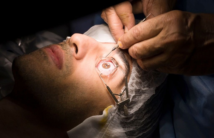 How LASIK Eye Surgery Can Transform Your Daily Routine