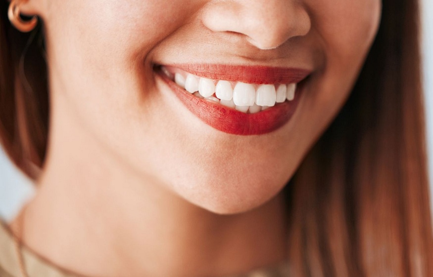 Can Composite Fillings Be Used for Both Front and Back Teeth?